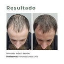 Nano Repair Growth Factor Anti Queda  Crescimento Capilar (3099)