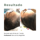 Nano Repair Growth Factor Anti Queda  Crescimento Capilar (3099)